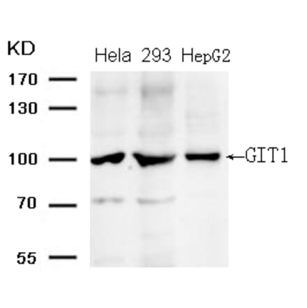 Western blot - GIT1 (Ab-383) Antibody from Signalway Antibody (21707) - Antibodies.com