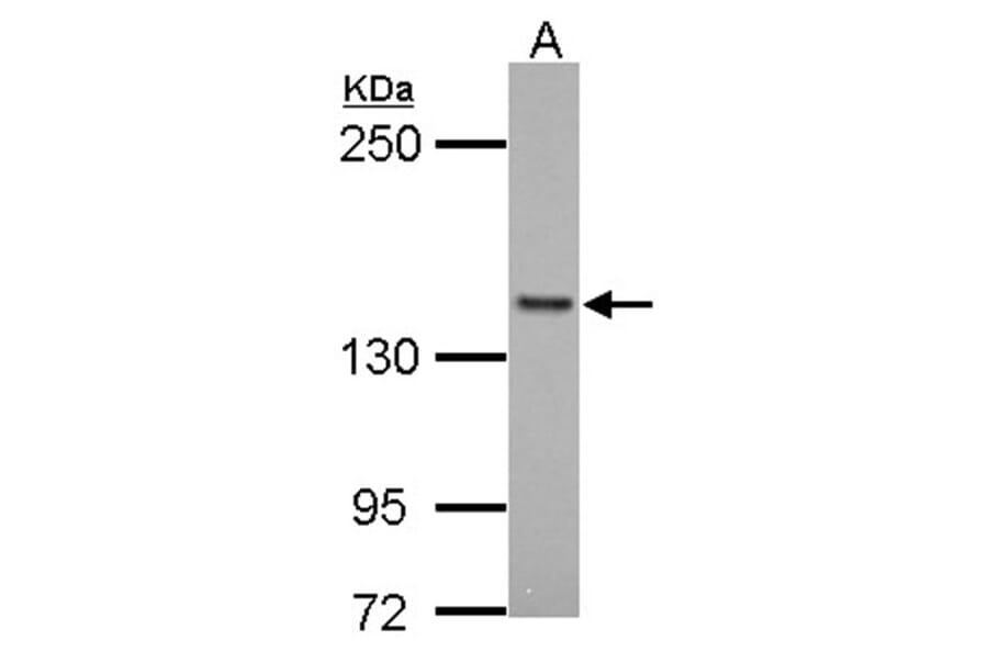 formin-like 1 antibody from Signalway Antibody (22776) - Antibodies.com