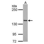 formin-like 1 antibody from Signalway Antibody (22776) - Antibodies.com