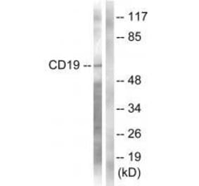 Western blot - CD19 (Ab-531) Antibody from Signalway Antibody (33130) - Antibodies.com