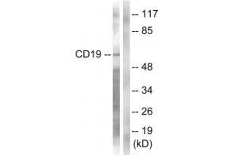 Western blot - CD19 (Ab-531) Antibody from Signalway Antibody (33130) - Antibodies.com