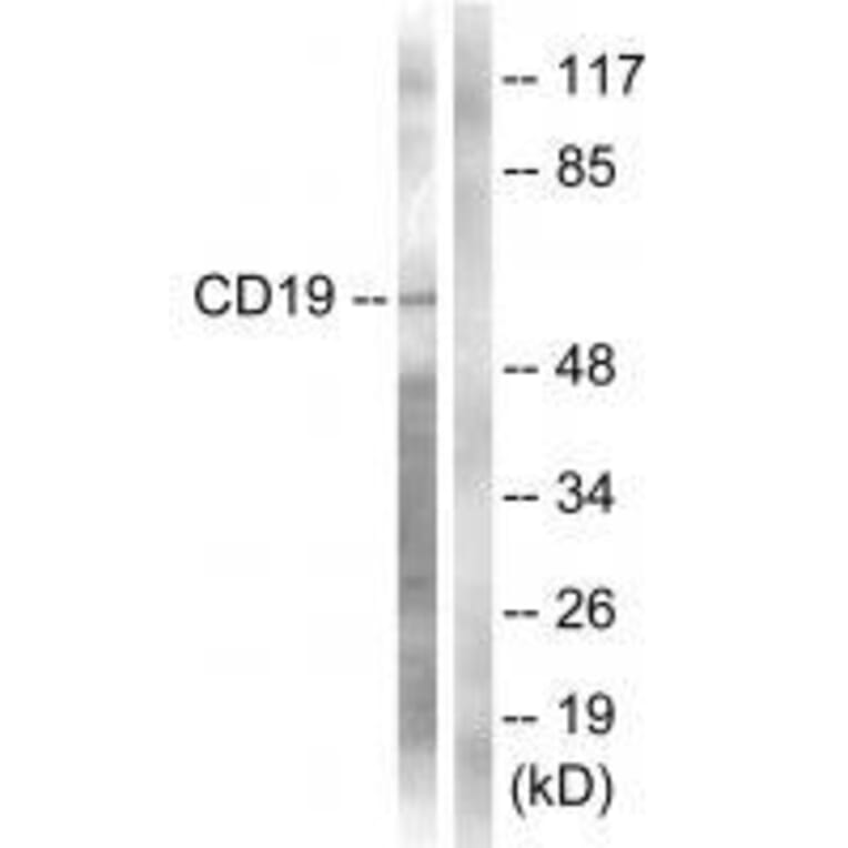 Western blot - CD19 (Ab-531) Antibody from Signalway Antibody (33130) - Antibodies.com