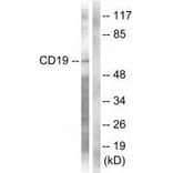 Western blot - CD19 (Ab-531) Antibody from Signalway Antibody (33130) - Antibodies.com