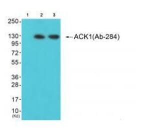 Western blot - ACK1 (Ab-284) Antibody from Signalway Antibody (33144) - Antibodies.com