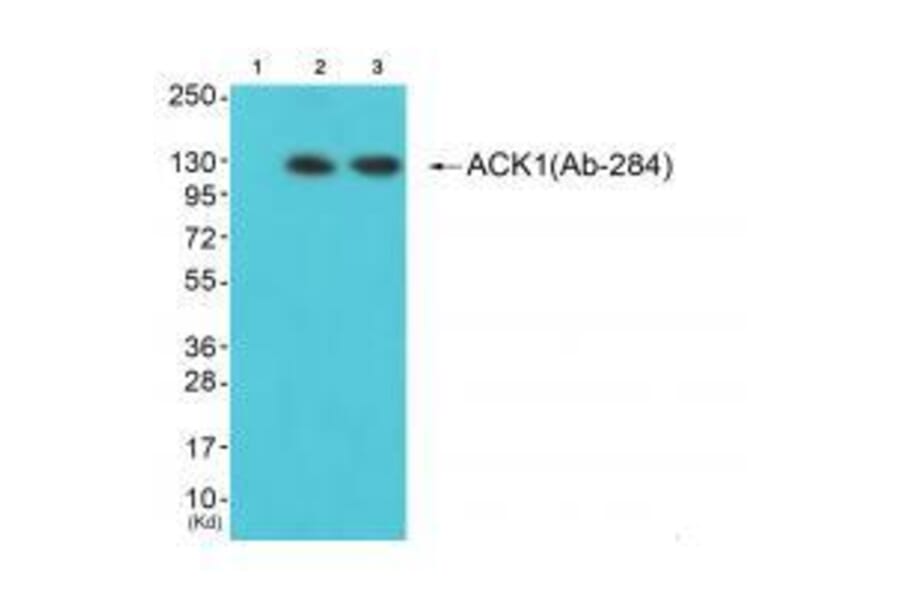 Western blot - ACK1 (Ab-284) Antibody from Signalway Antibody (33144) - Antibodies.com
