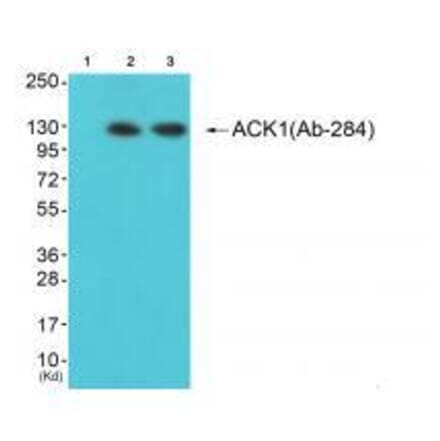 Western blot - ACK1 (Ab-284) Antibody from Signalway Antibody (33144) - Antibodies.com