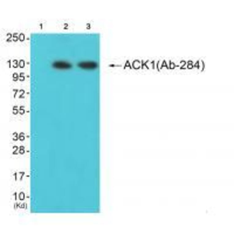 Western blot - ACK1 (Ab-284) Antibody from Signalway Antibody (33144) - Antibodies.com