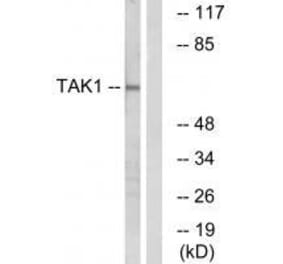 Western blot - TAK1 (Ab-184) Antibody from Signalway Antibody (33174) - Antibodies.com