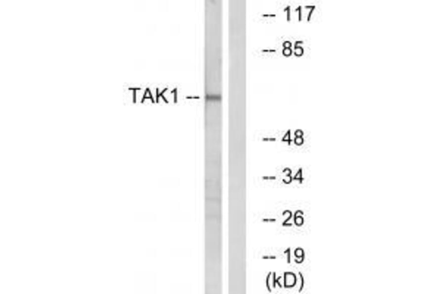 Western blot - TAK1 (Ab-184) Antibody from Signalway Antibody (33174) - Antibodies.com