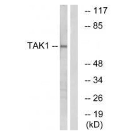 Western blot - TAK1 (Ab-184) Antibody from Signalway Antibody (33174) - Antibodies.com