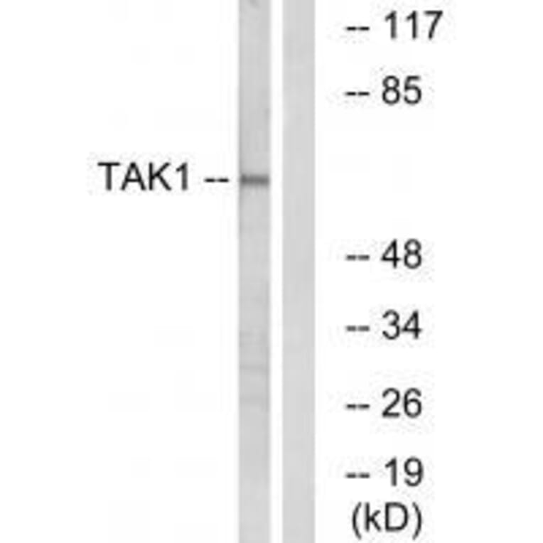 Western blot - TAK1 (Ab-184) Antibody from Signalway Antibody (33174) - Antibodies.com