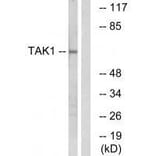 Western blot - TAK1 (Ab-184) Antibody from Signalway Antibody (33174) - Antibodies.com