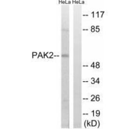 Western blot - PAK2 (Ab-141) Antibody from Signalway Antibody (33243) - Antibodies.com