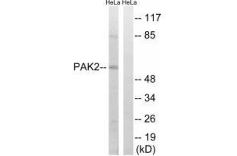 Western blot - PAK2 (Ab-141) Antibody from Signalway Antibody (33243) - Antibodies.com