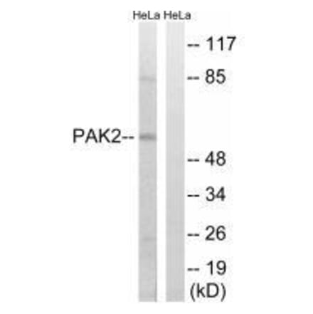 Western blot - PAK2 (Ab-141) Antibody from Signalway Antibody (33243) - Antibodies.com
