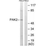 Western blot - PAK2 (Ab-141) Antibody from Signalway Antibody (33243) - Antibodies.com