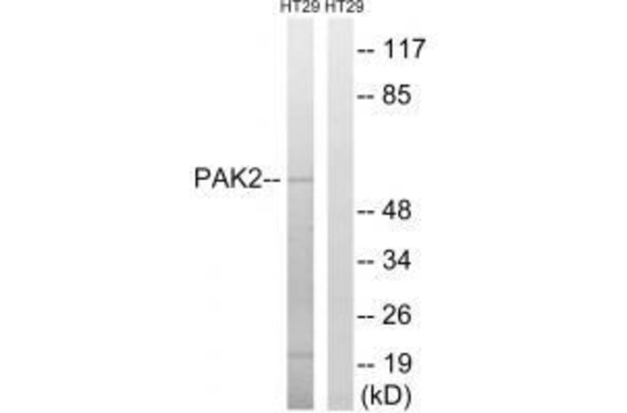 Western blot - PAK2 (Ab-197) Antibody from Signalway Antibody (33244) - Antibodies.com