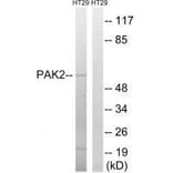 Western blot - PAK2 (Ab-197) Antibody from Signalway Antibody (33244) - Antibodies.com