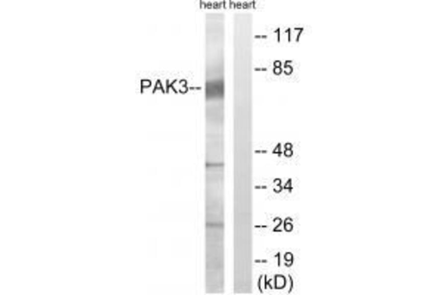 Western blot - PAK3 (Ab-154) Antibody from Signalway Antibody (33245) - Antibodies.com