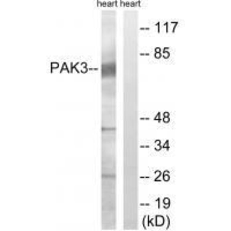 Western blot - PAK3 (Ab-154) Antibody from Signalway Antibody (33245) - Antibodies.com