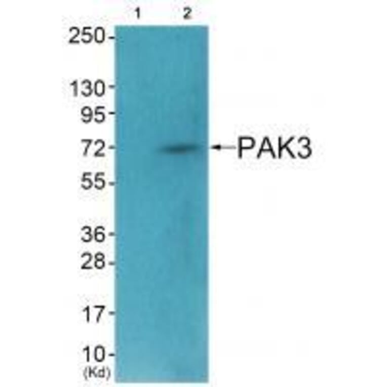 Western blot - PAK3 (Ab-154) Antibody from Signalway Antibody (33245) - Antibodies.com
