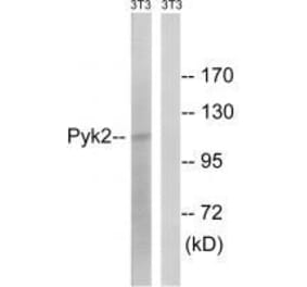 Western blot - PYK2 (Ab-579) Antibody from Signalway Antibody (33267) - Antibodies.com