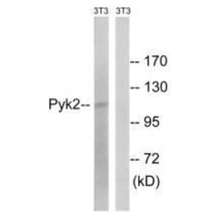 Western blot - PYK2 (Ab-579) Antibody from Signalway Antibody (33267) - Antibodies.com