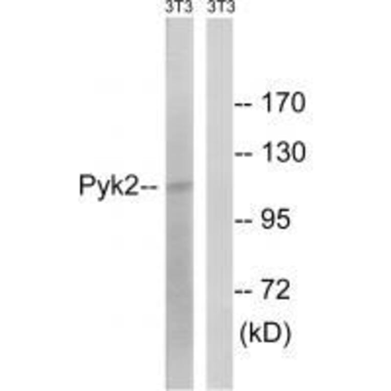 Western blot - PYK2 (Ab-579) Antibody from Signalway Antibody (33267) - Antibodies.com