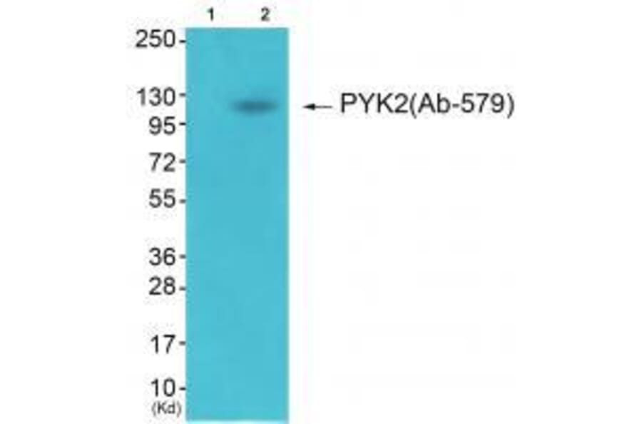 Western blot - PYK2 (Ab-579) Antibody from Signalway Antibody (33267) - Antibodies.com
