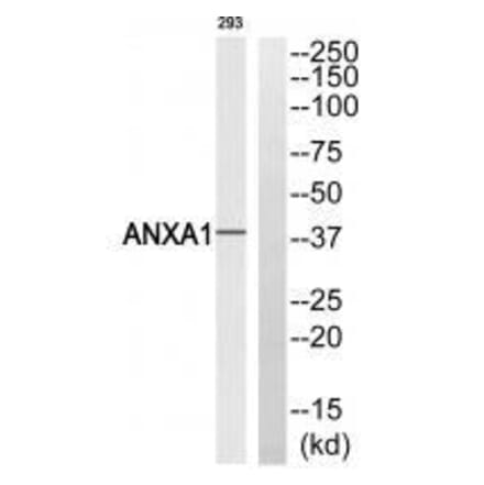 Western blot - ANXA1 (Ab-21) Antibody from Signalway Antibody (33272) - Antibodies.com