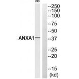 Western blot - ANXA1 (Ab-21) Antibody from Signalway Antibody (33272) - Antibodies.com