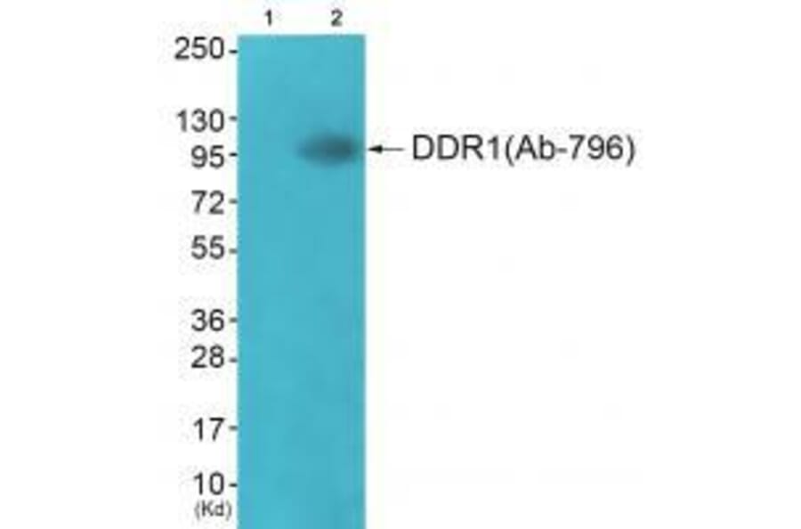 Western blot - DDR1 (Ab-796) Antibody from Signalway Antibody (33308) - Antibodies.com