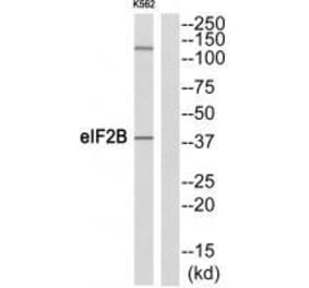 Western blot - eIF2B (Ab-67) Antibody from Signalway Antibody (33319) - Antibodies.com