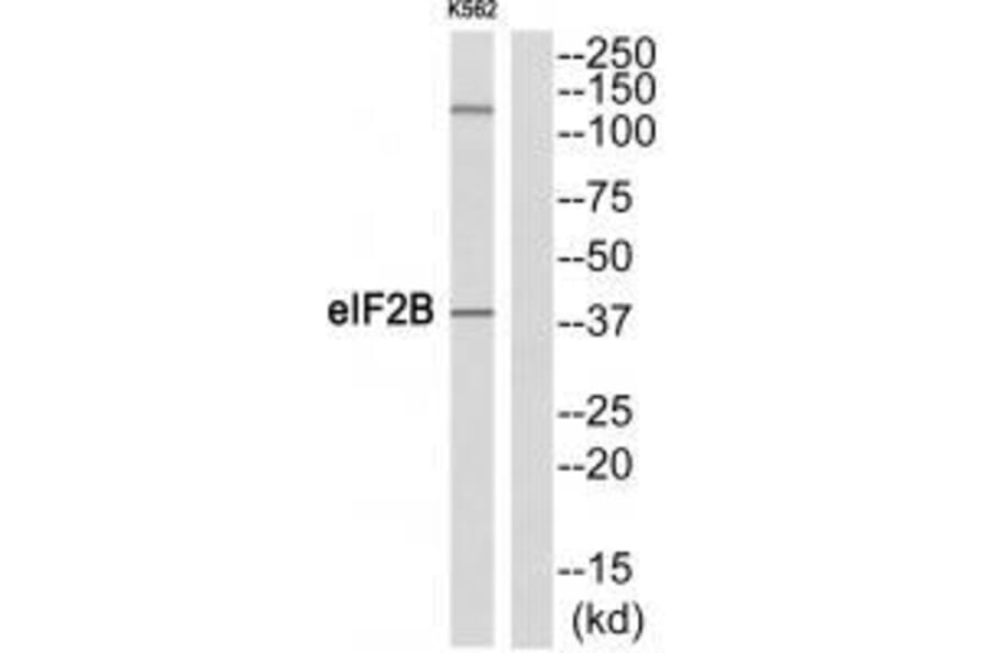 Western blot - eIF2B (Ab-67) Antibody from Signalway Antibody (33319) - Antibodies.com