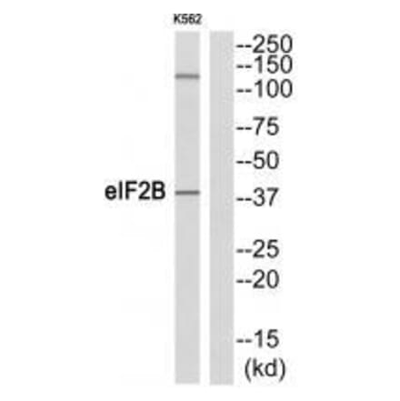 Western blot - eIF2B (Ab-67) Antibody from Signalway Antibody (33319) - Antibodies.com