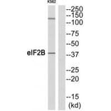 Western blot - eIF2B (Ab-67) Antibody from Signalway Antibody (33319) - Antibodies.com