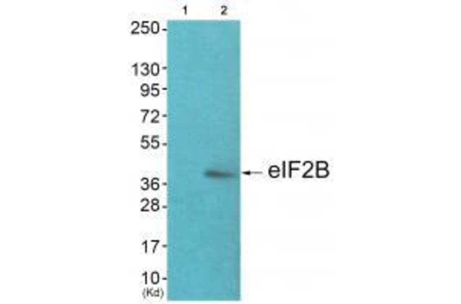 Western blot - eIF2B (Ab-67) Antibody from Signalway Antibody (33319) - Antibodies.com
