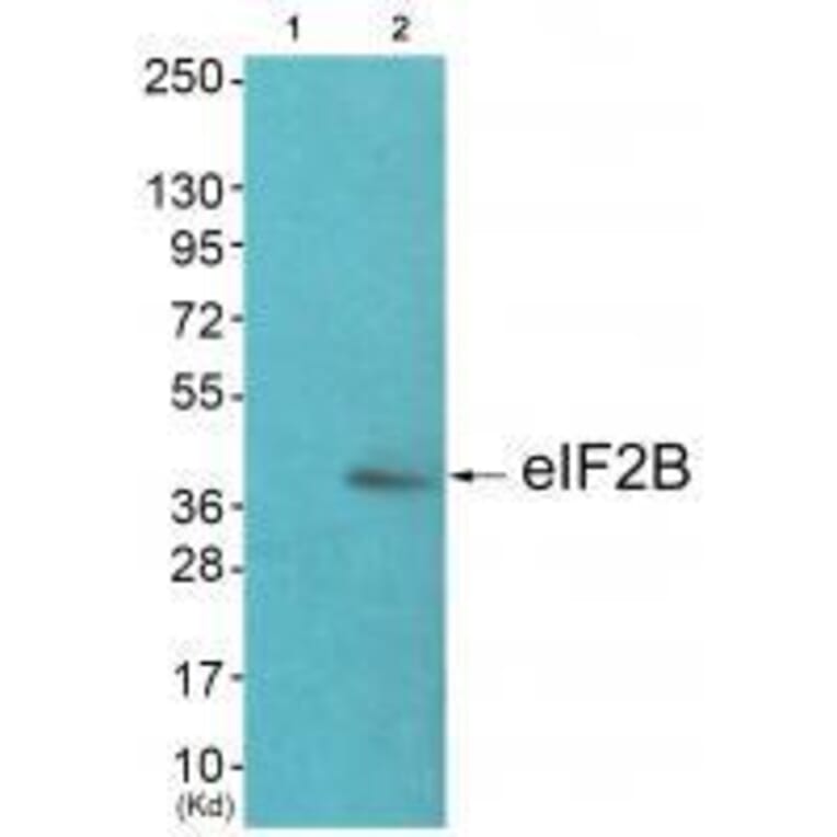 Western blot - eIF2B (Ab-67) Antibody from Signalway Antibody (33319) - Antibodies.com