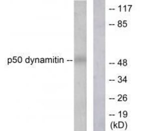 Western blot - p50 Dynamitin Antibody from Signalway Antibody (33461) - Antibodies.com