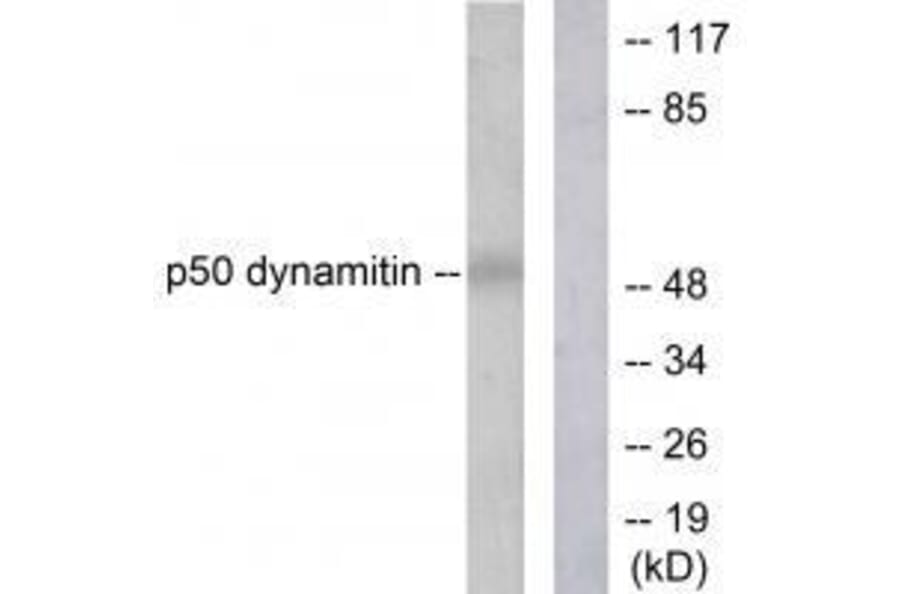Western blot - p50 Dynamitin Antibody from Signalway Antibody (33461) - Antibodies.com