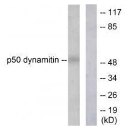 Western blot - p50 Dynamitin Antibody from Signalway Antibody (33461) - Antibodies.com
