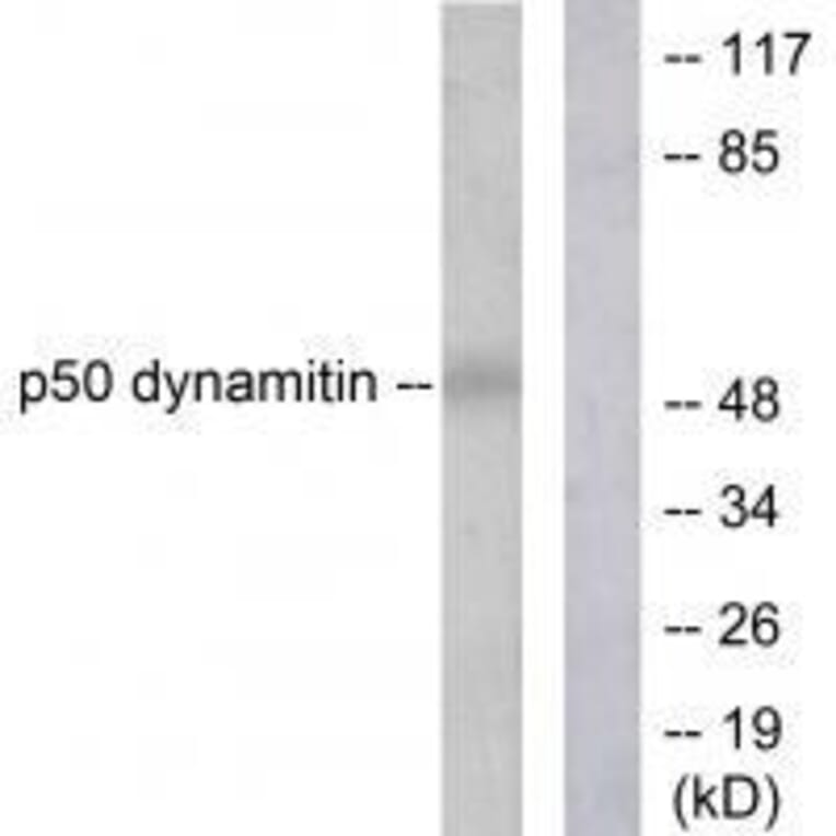 Western blot - p50 Dynamitin Antibody from Signalway Antibody (33461) - Antibodies.com