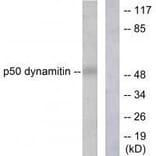 Western blot - p50 Dynamitin Antibody from Signalway Antibody (33461) - Antibodies.com