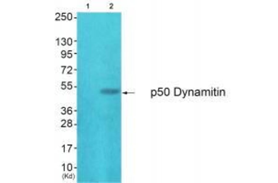 Western blot - p50 Dynamitin Antibody from Signalway Antibody (33461) - Antibodies.com