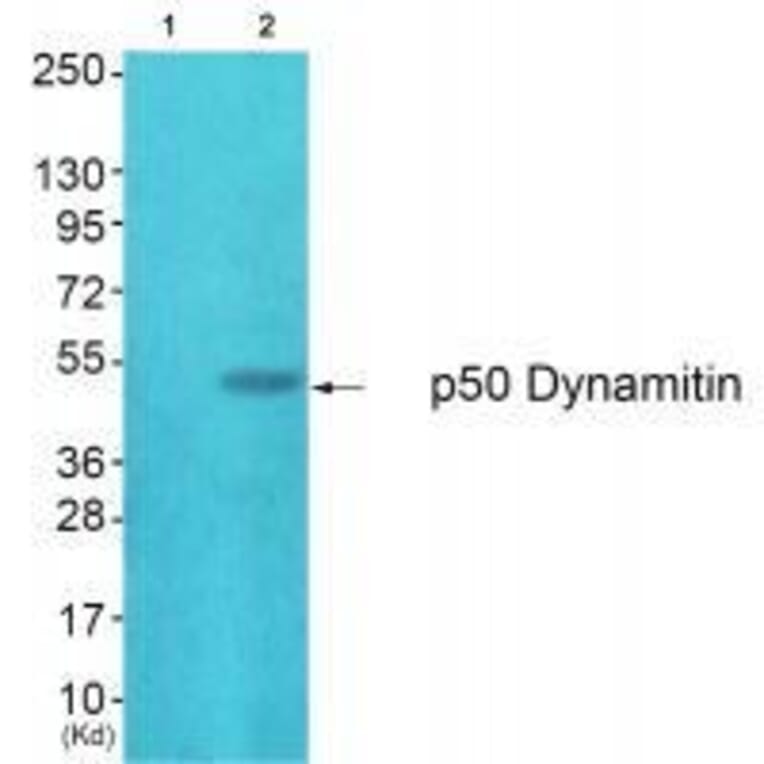 Western blot - p50 Dynamitin Antibody from Signalway Antibody (33461) - Antibodies.com