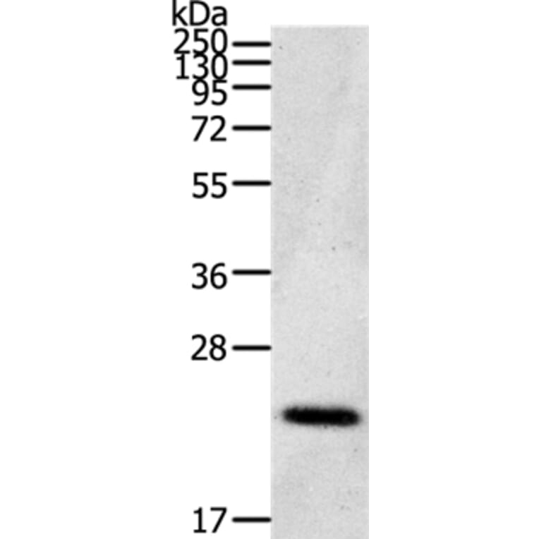 CDC42/RHO/RAC Antibody from Signalway Antibody (36743) - Antibodies.com