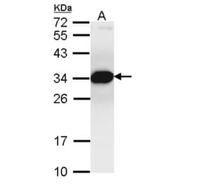 Proteasome inhibitor PI31 subunit antibody from Signalway Antibody (22722) - Antibodies.com