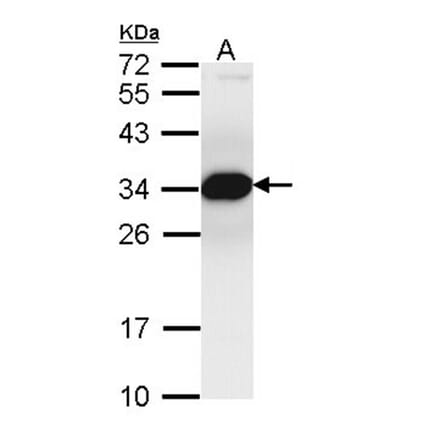 Proteasome inhibitor PI31 subunit antibody from Signalway Antibody (22722) - Antibodies.com