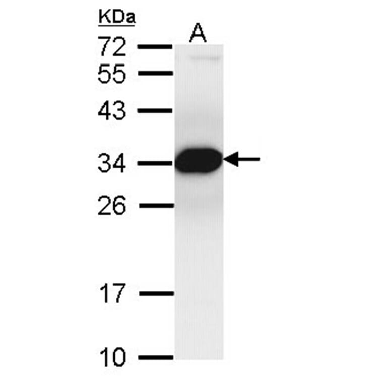 Proteasome inhibitor PI31 subunit antibody from Signalway Antibody (22722) - Antibodies.com