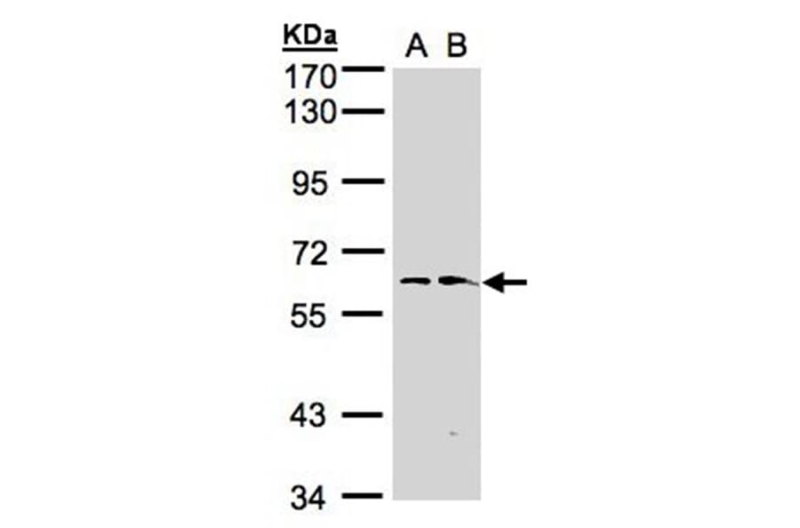 flavin containing monooxygenase 1 antibody from Signalway Antibody (22997) - Antibodies.com
